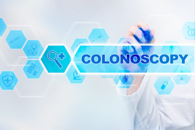 Colonoscopy